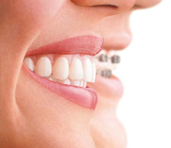 Yamada Viggiano Ortodoncia | Ortodoncia en Pachuca