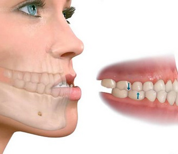 Yamada Viggiano Ortodoncia | Ortodoncia en Pachuca